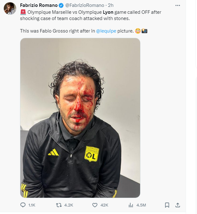 🤕里昂巴士遇袭！格罗索教练脸部流血 与马赛的“教练德比”推迟